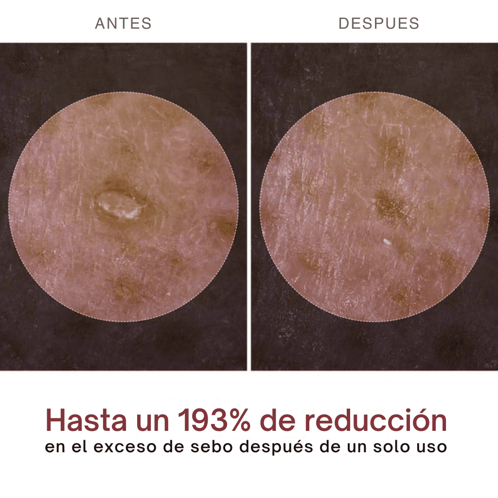 Exfoliantes Dr. Melaxil eliminan puntos negros, espinillas y manchas